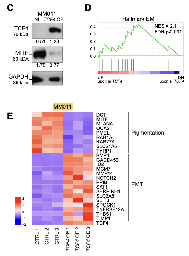 黑色素瘤细胞系里面针对TCF4进行过表达