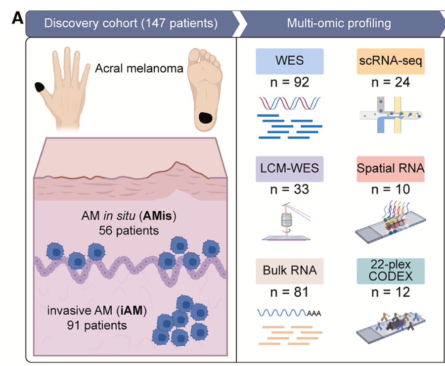 多组学来量化原位和侵袭的肢端黑色素瘤差异 